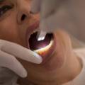 Limpieza dental: por qué es importante y cada cuánto deberías hacerla