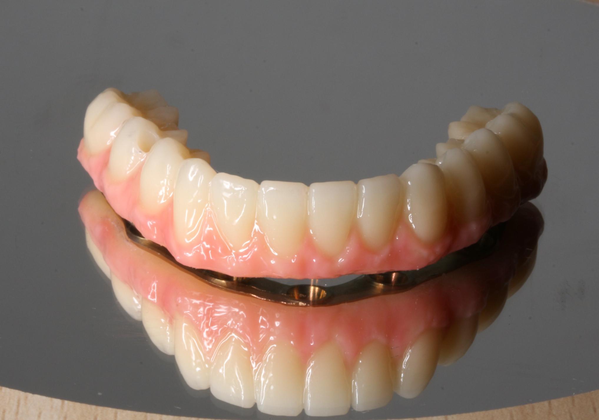 Laboratorio dental digital